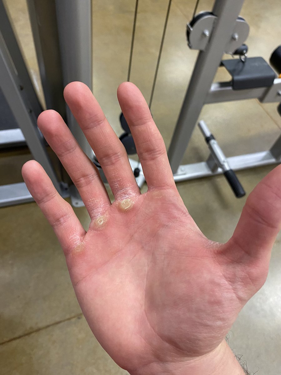 my fellow gym people how does your hand look