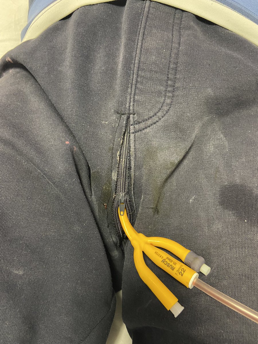 Creativity of my patient after TUR-BT @ozeruralcakici <a href="/drserdarc/">Bisikletli Ürolog</a> <a href="/DrOrcunCelik/">orcun.celik</a> <a href="/Volkan_Ulker_MD/">Volkan Ulker, MD, FEBU</a> <a href="/so_uro/">UroSoMe</a> <a href="/brurology_group/">Brazilian Reconstructive Urology Group</a> <a href="/UroStuds/">Urology for Students</a>