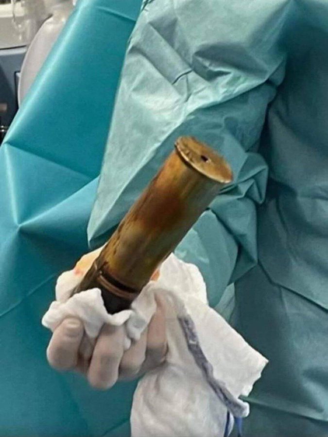 An 88-year-old Frenchman presented at Toulon A&E yesterday with a First World War shell shoved up his arse. Bomb disposal were called to make it safe. The hospital was evacuated. I wish this was a joke.