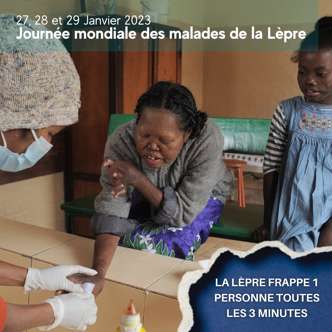 RaoulFollereau's tweet photo. Le saviez-vous ?
🧒 Dans le monde, la lèpre frappe encore 1 personne toutes les 3 minutes.
🧒 1 malade sur 10 est un enfant.
 
#Lèpre #JournéeMondialedesMaladesdelaLèpre #Leprosy #Soigner #Santé #Maladie #AimerAgir #Solidarité #Mobilisation #StopponslaLèpre
📸 Tom Yann https://t.co/RLmN3ci6mH