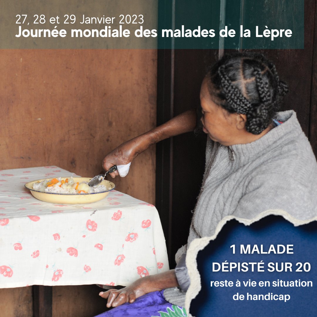 RaoulFollereau's tweet photo. Le saviez-vous ?
😔 1 malade dépisté sur 20 reste à vie en situation de handicap lié à la lèpre.
 
#Lèpre #JournéeMondialedesMaladesdelaLèpre #Leprosy #Santé #Maladie #AimerAgir #Solidarité #Mobilisation #HansensDisease
📸 Tom Yann https://t.co/GiiQvAnIwR
