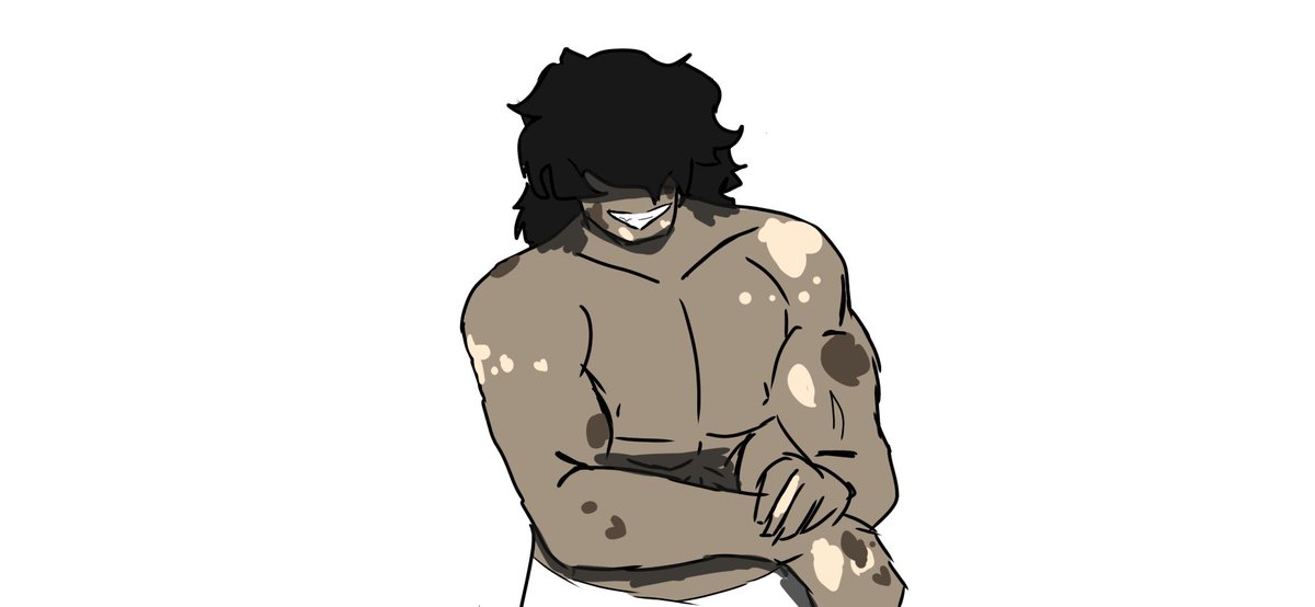 Charmie13's tweet photo. @foxy897_uwu15 He has vitiligo:) https://t.co/2le1pPLgdw