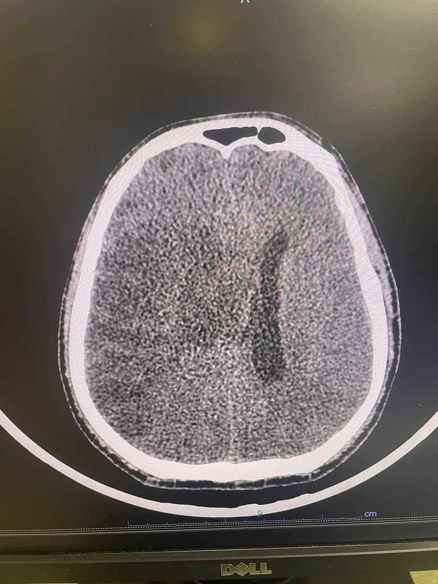 OrlandoRPN's tweet photo. Algo Terrible… va llegando a UCI… 🧠 https://t.co/YN0UakVz3m