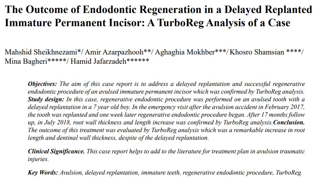 JOCPD_1974's tweet image. 【Article Title】“Evidence of Association between MTRR and TNF-α Gene Polymorphisms and Oral Health Related Quality of Life in Children with Anterior Open Bite”

【Click】jocpd.com/articles/10.17…

#Openbite; #Malocclusion;#Qualityoflife;#Geneticpolymorphism;