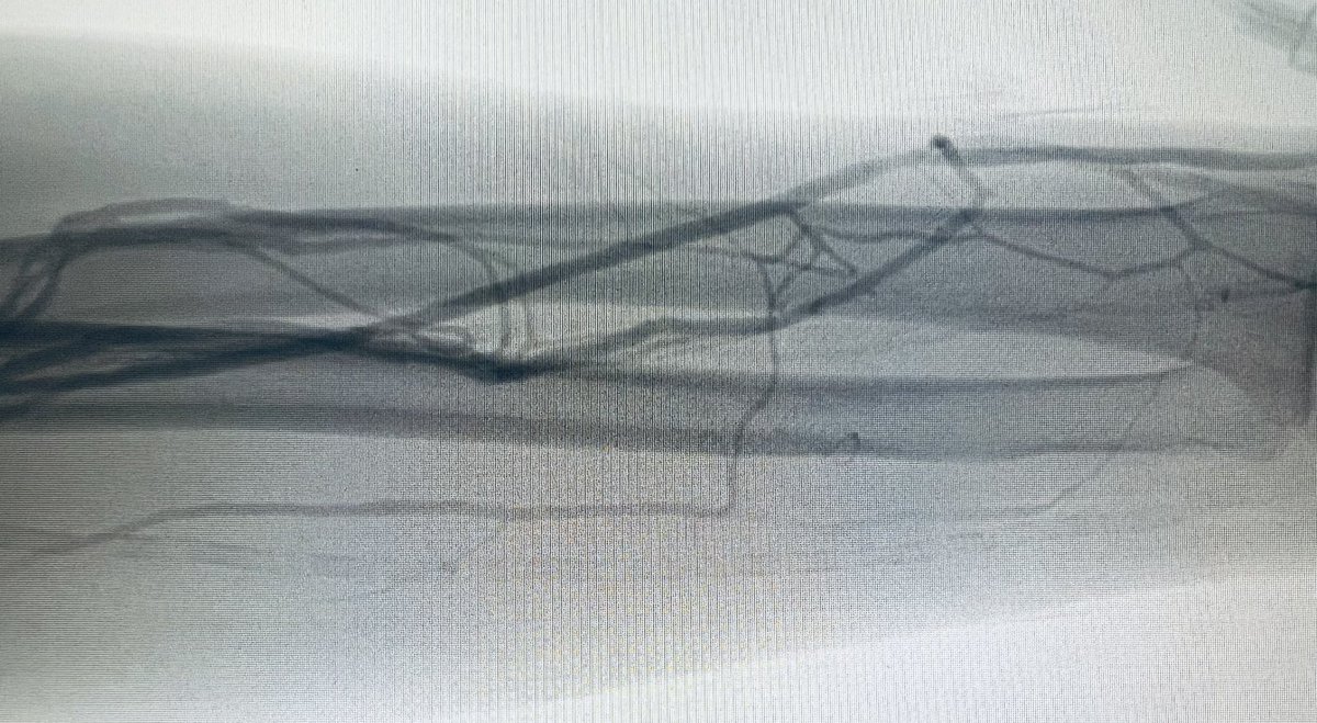 Monnie Wasse, MD, MPH tweet media