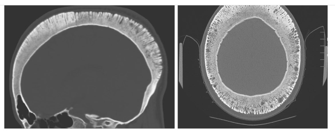 Oren Gottfried, MD tweet media