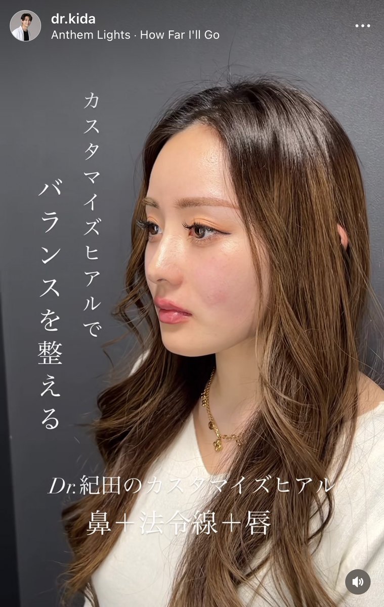 agoagomi_03's tweet photo. リールで回ってきた症例良すぎるな https://t.co/2f4ggtLSwn