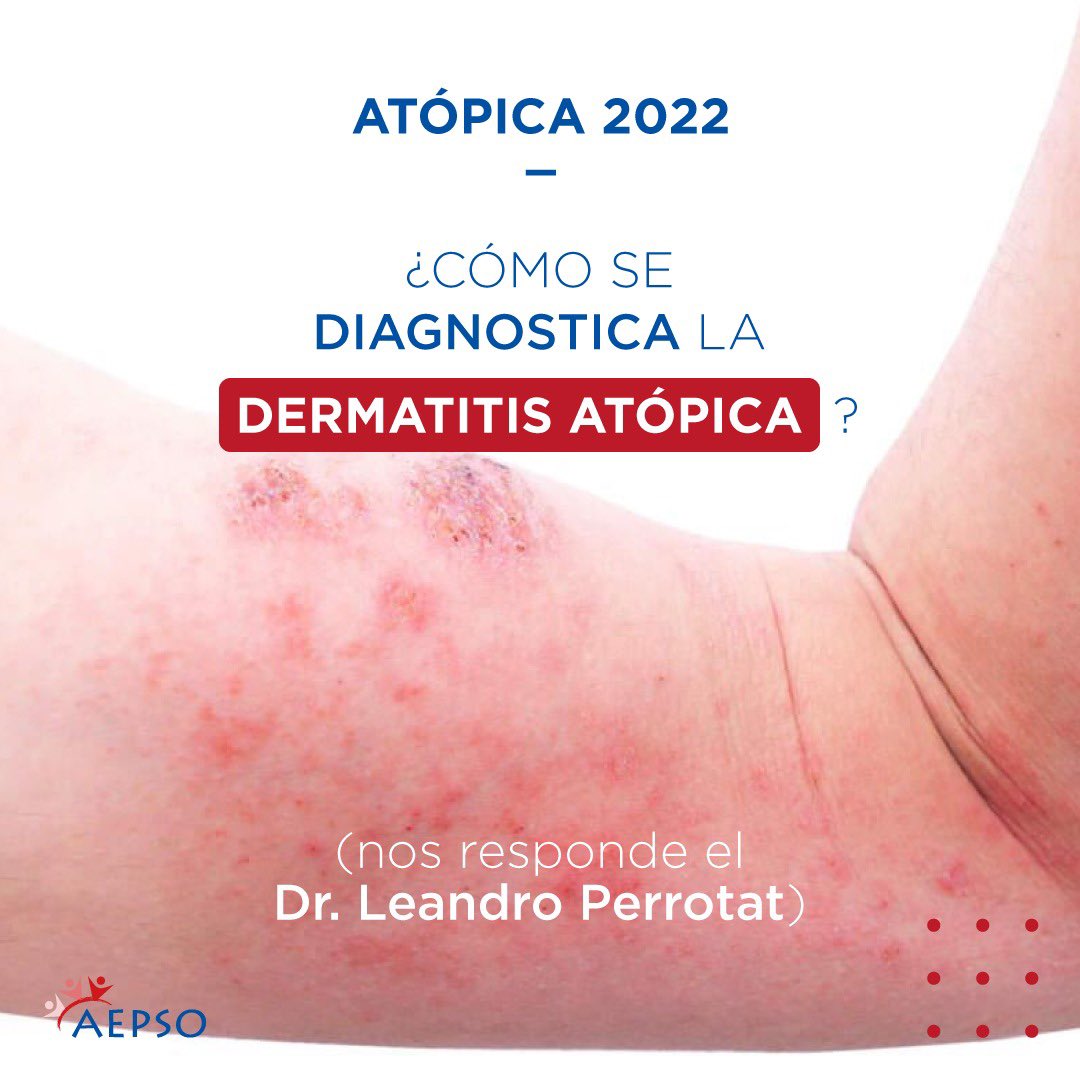 aepso_da's tweet photo. ⚪ Si no pudiste estar en 𝗔𝗧𝗢𝗣𝗜𝗞𝗔 𝟮𝟬𝟮𝟮, te contamos algunas 🅟🅔🅡🅛🅘🅣🅐🅢
@silviafbarrio @soarpso @AAAEIC_ @IADPO
#diagnosticodermatitisatopica #comosediagnosticadermatitisatopica #picazon #ardor #descamacion #aepso_da https://t.co/j4AgPqKP4A