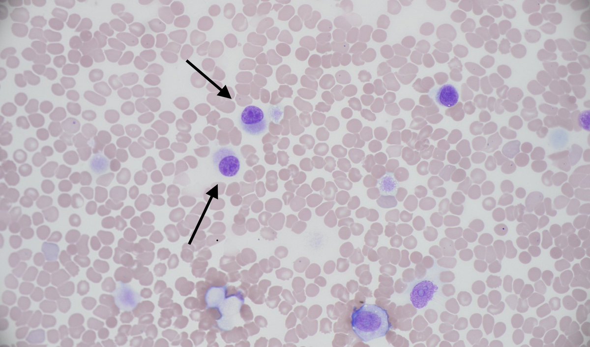 Brooj Abro, MD tweet media