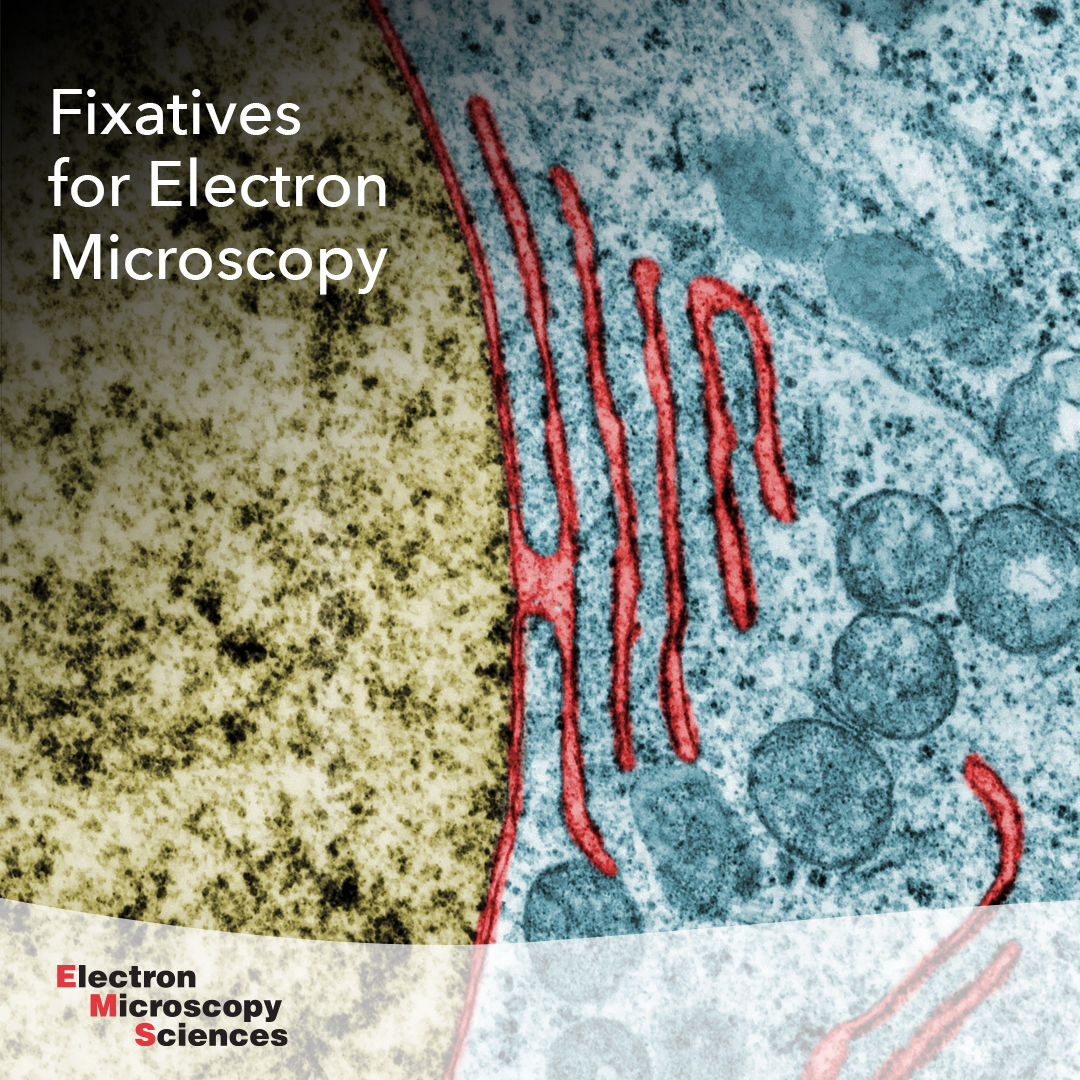 EMSDIASUM's tweet photo. Here's a summary of popular fixatives for EM, their functions, and other benefits... https://t.co/3Ye26aHc7z

#EMShasit #chemistry #histology #biology #cryo  #electronmicroscopy #microscopy #microtomy #imaging #pathology #neuroscience #laboratory #specimen #labsupplies #TEM #SEM https://t.co/YfDRYxSWIU