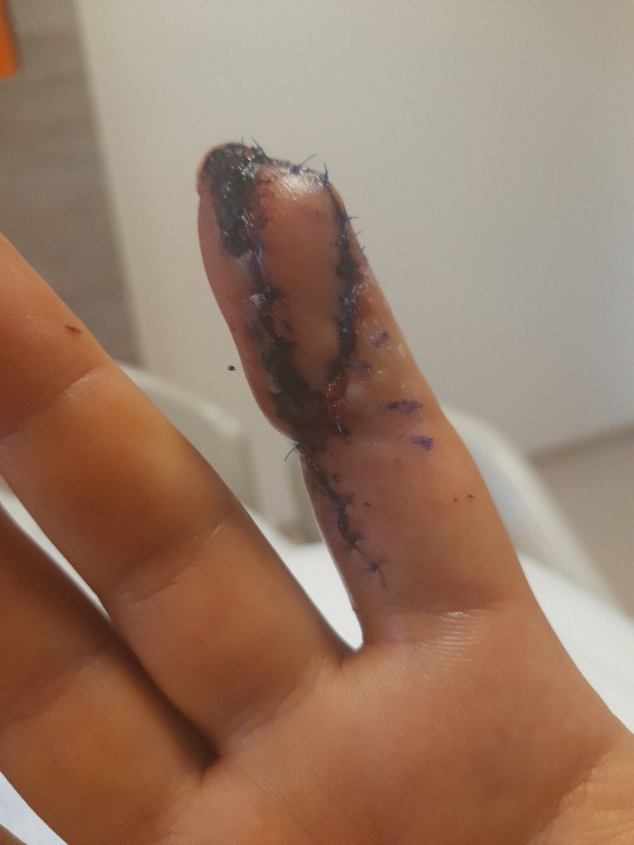 Mustafaozel01's tweet photo. Allahım bu 4 düncü ameliyat sen şifa ver yarabbim bir an an önce işimin başına geçeyim namerde muhtaç olmayım şifa senden  yarabbim rabbim kimseyi sağlığından etmesin kimseye kaza bela vermesin https://t.co/FaLznNJUdu
