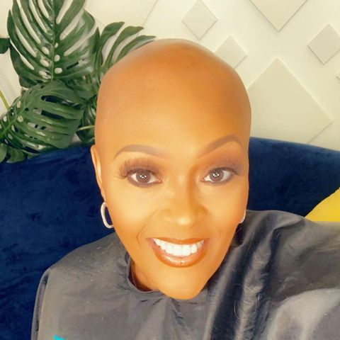 dome_our's tweet photo. Today's feature: @alopecian_royalty

Grace is the face that love wears when it meets imperfection. - Unknown 

#OurFreeDomeSpotlight https://t.co/2Oz4bW5Duq