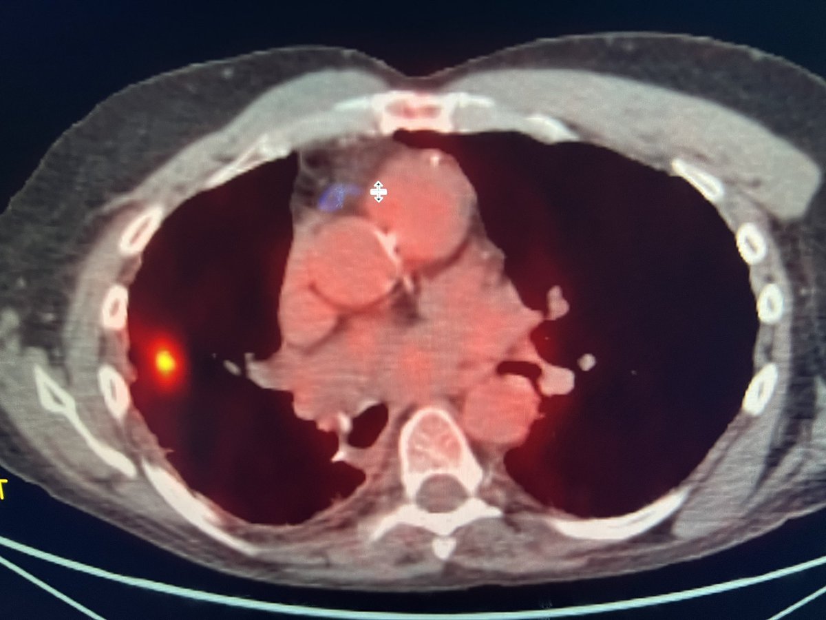 Joe Mammarappallil tweet media