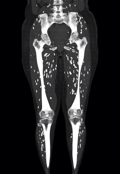 OGdukeneurosurg's tweet photo. Teach us about this problem! https://t.co/Fk4bLghVMJ
