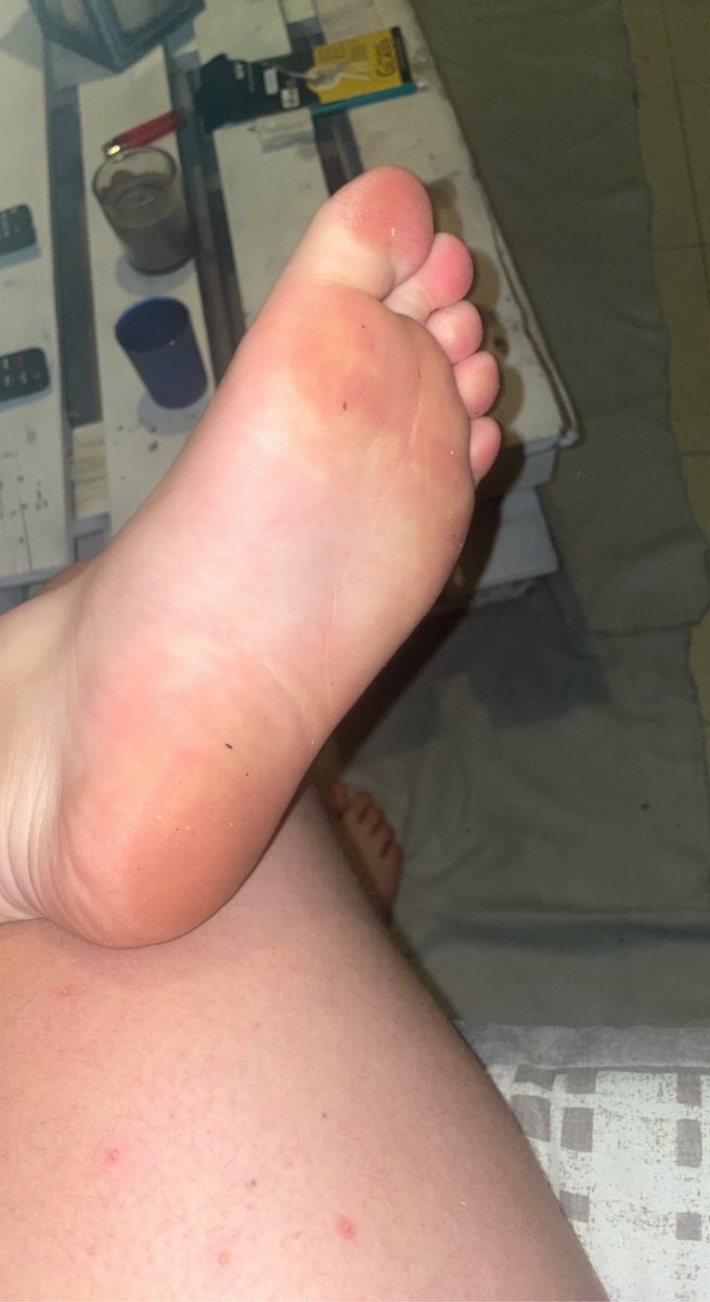 deesseemmaa's tweet photo. mes pieds sont toujours à vendre #moneyslave #moneyslavefrance #feet #findom https://t.co/PRLwzBNuNf