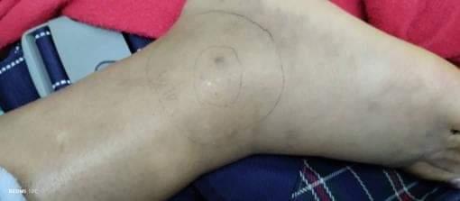Heberlizeth's tweet photo. #ServicioPúblico

Se requiere de urgencia suero antiofídico para la señora Migdalia Josefina González León de 46 años, recluida en el Hospital Central de Valencia. Fue mordida por serpiente mapanare el pasado domingo en Canoabo, Bejuma. Teléfono de contacto 0424-4150794. https://t.co/w15et0lgmO