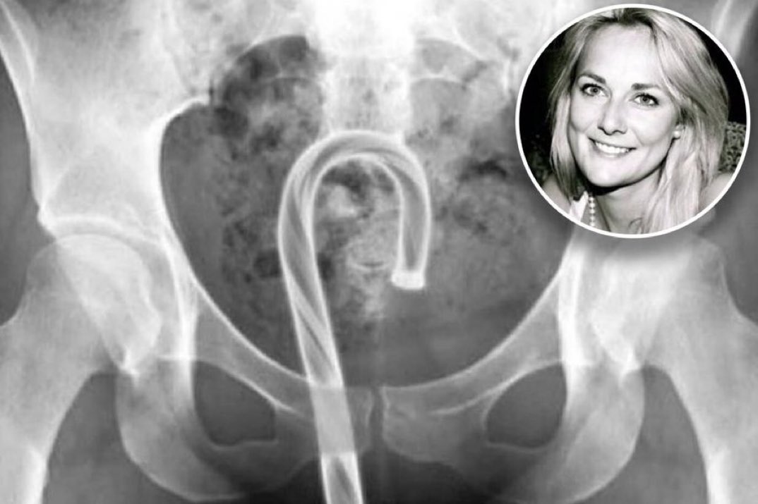 Don't masturbate with Christmas ornaments doctor warns amid spike in seasonal injuries‼️🍭