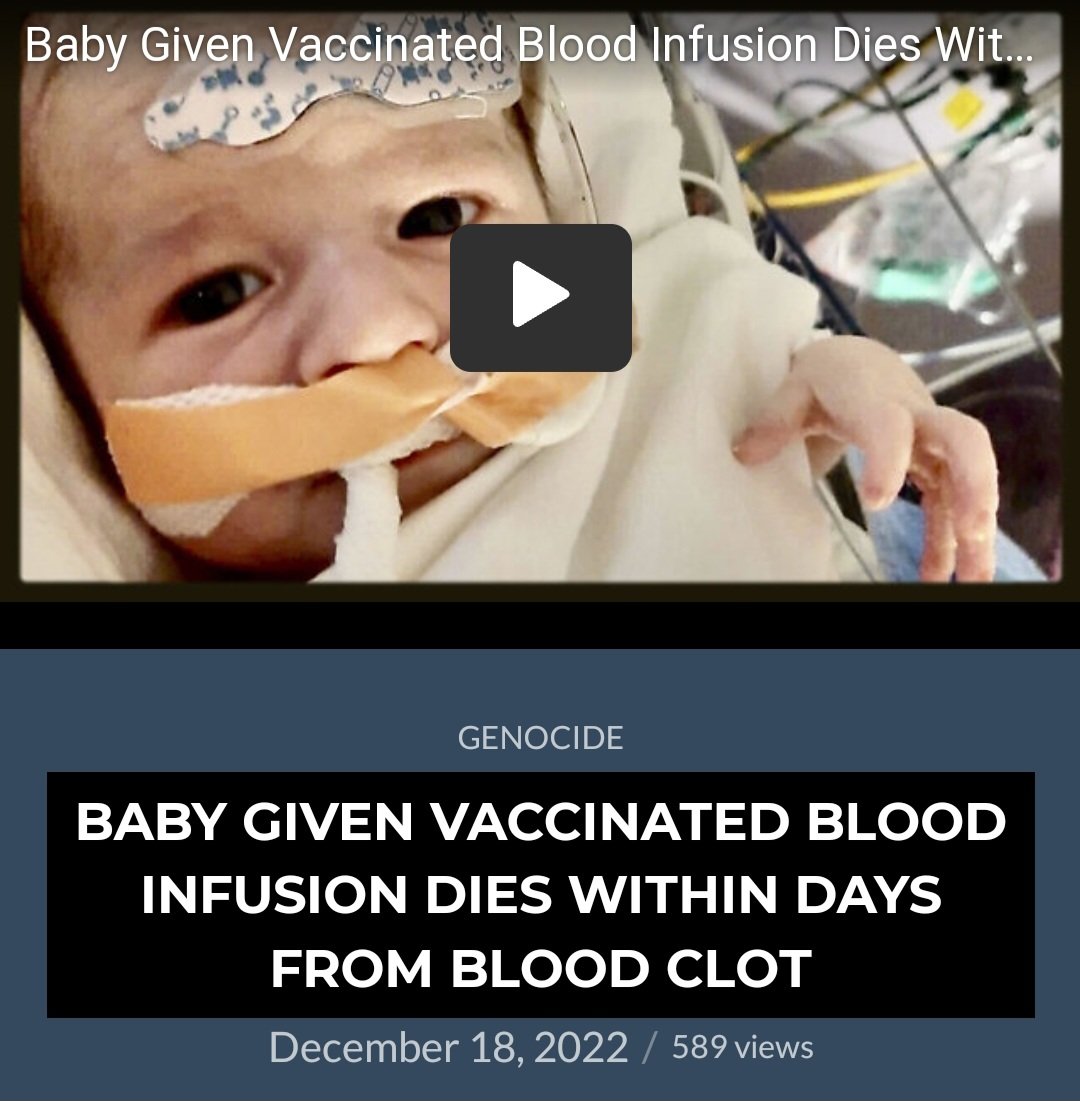 america_parents's tweet photo. Baby Alex died from the vaccinated blood infusion. He never made it to surgery. My heart breaks for baby Alex and his parents...
Link to article:
https://t.co/Ga9nR8sj78
#WashingtonState #mRNAvaccine #babyAlex #bloodinfusion https://t.co/TiiGw8xMbB