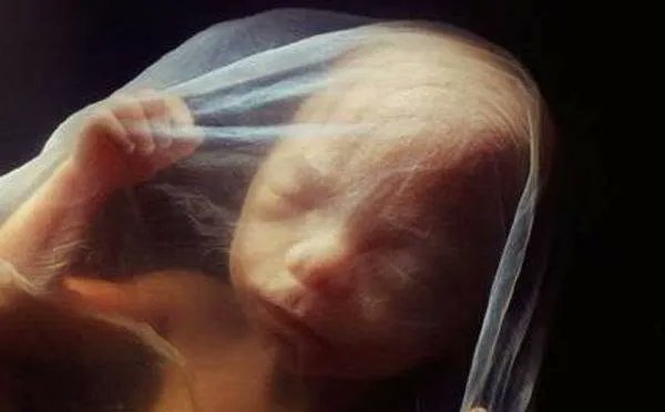 LifeNewsHQ's tweet photo. VICTORY! Guam Legislature Passes Bill Banning Abortions When Unborn Baby’s Heart Begins Beating https://t.co/vDpSmouaRj https://t.co/e5xlnEIeWo