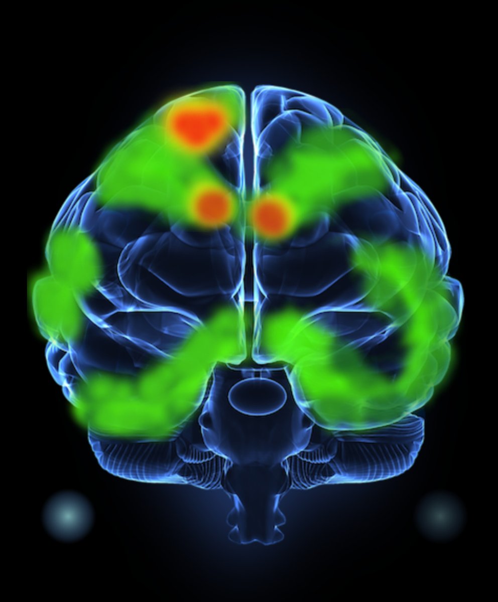 RTAtkinson's tweet image. Being exploring the Bilateral Stimulation lately and the effects of increased Attentional Flexibility it has. There definitely is something to it, beyond just relaxation and stress release.
