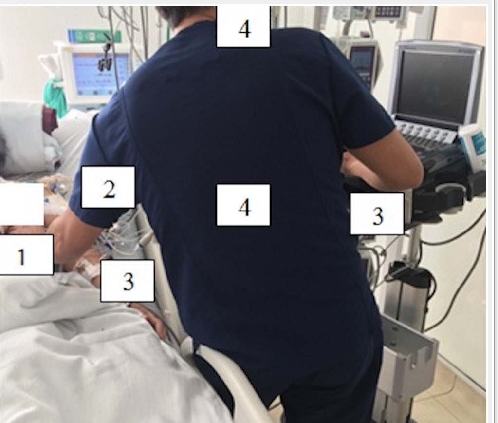 MAecocardio's tweet image. Como evitar hacerte una lesión osteomuscular cuando realizas un ecocardiograma
ecocardio.com/documentos/ret…