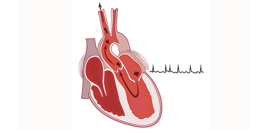 MedscapeCME's tweet image. ➡️ Do you know how and when to make the diagnosis of chronic #thromboembolic pulmonary #hypertension? Listen in as our experts discuss the latest tools for diagnosis and management. #MedEd #CME #MedTwitter
📍 ms.spr.ly/6012ektVK