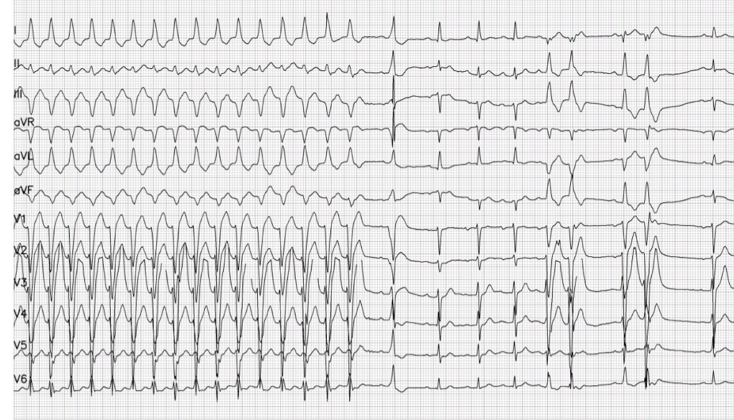 What's the diagnosis? <a href="/EPeeps_Bot/">EP_Bot</a> <a href="/Fra_Vitali90/">Francesco Vitali</a> <a href="/FSanguettoli/">Federico Sanguettoli</a> <a href="/antonellascl95/">Antonella Scala</a> <a href="/MatteoBertini5/">MatteoBertini</a> <a href="/malagu_m/">Michele Malagù</a> <a href="/NicolaBianchi95/">Nicola Bianchi</a> <a href="/IennoLuca/">Luca Di Ienno</a> <a href="/MarcoMicillo1/">Marco Micillo</a> 
#EPeeps