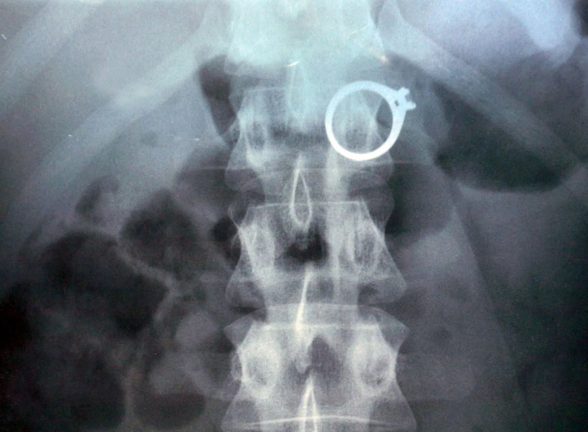 Da_Robfather's tweet photo. @SixBrownChicks Be safe get that X-Ray you never know 🤣🤣🤣 https://t.co/vbGKVuM9El