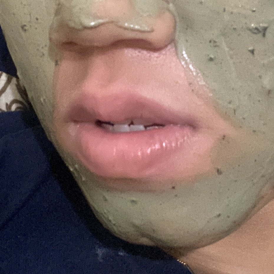 ‼️BIBIR❗️

Iseng liatin foto lama ternyata makin kesini ada perubahan di warna bibir aku.

Awalnya aku ga notice sama sekali, tapi kl dibandingin sm foto lama kok kyk ada perubahan gituu, jd aku mau share beberapa lip care yg sering aku pake

From this                     To this