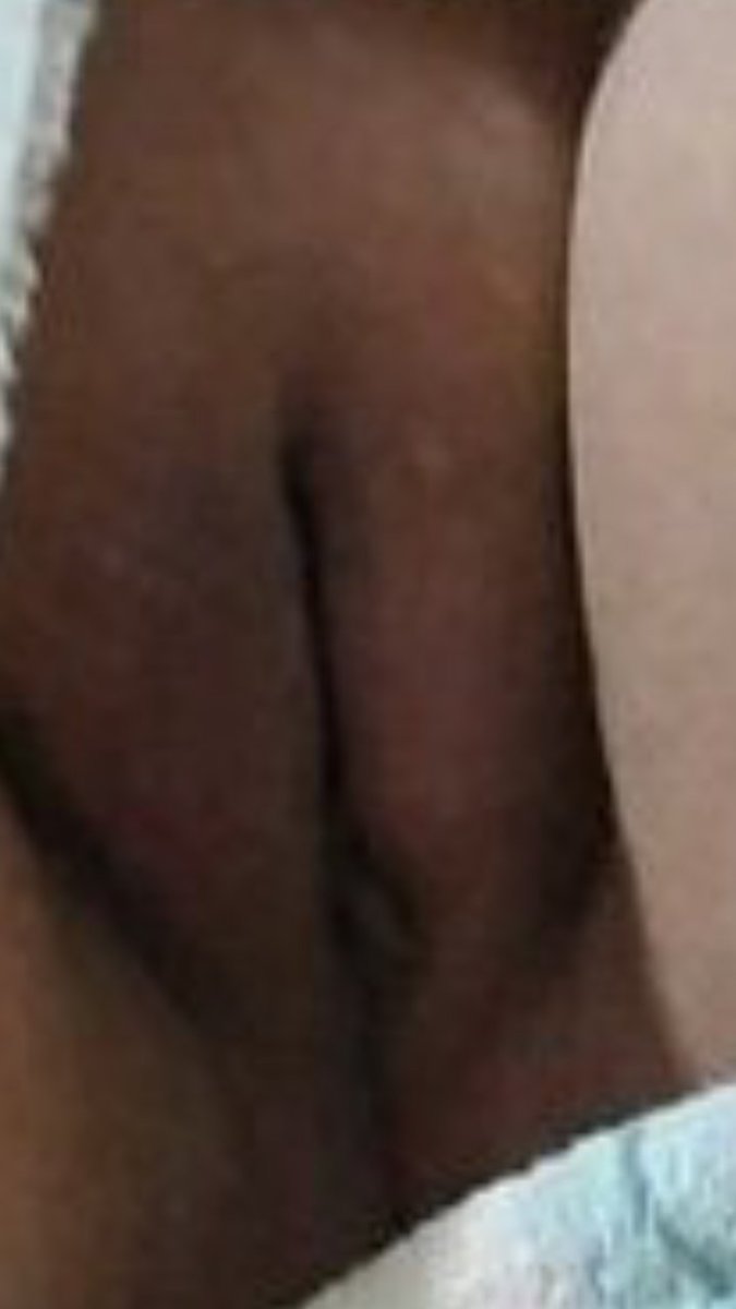 bu istiyormu istemiyormu