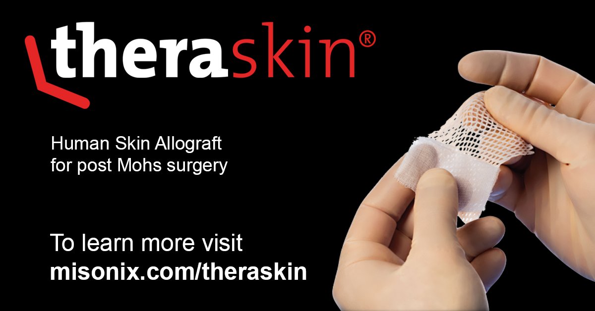 To treat wounds after Mohs surgery, consider TheraSkin human skin allograft. TheraSkin is appropriate for use from head to toe, all depths, and all wound types. 

Visit misonix.com/theraskin for clinical evidence, reimbursement information, and more.