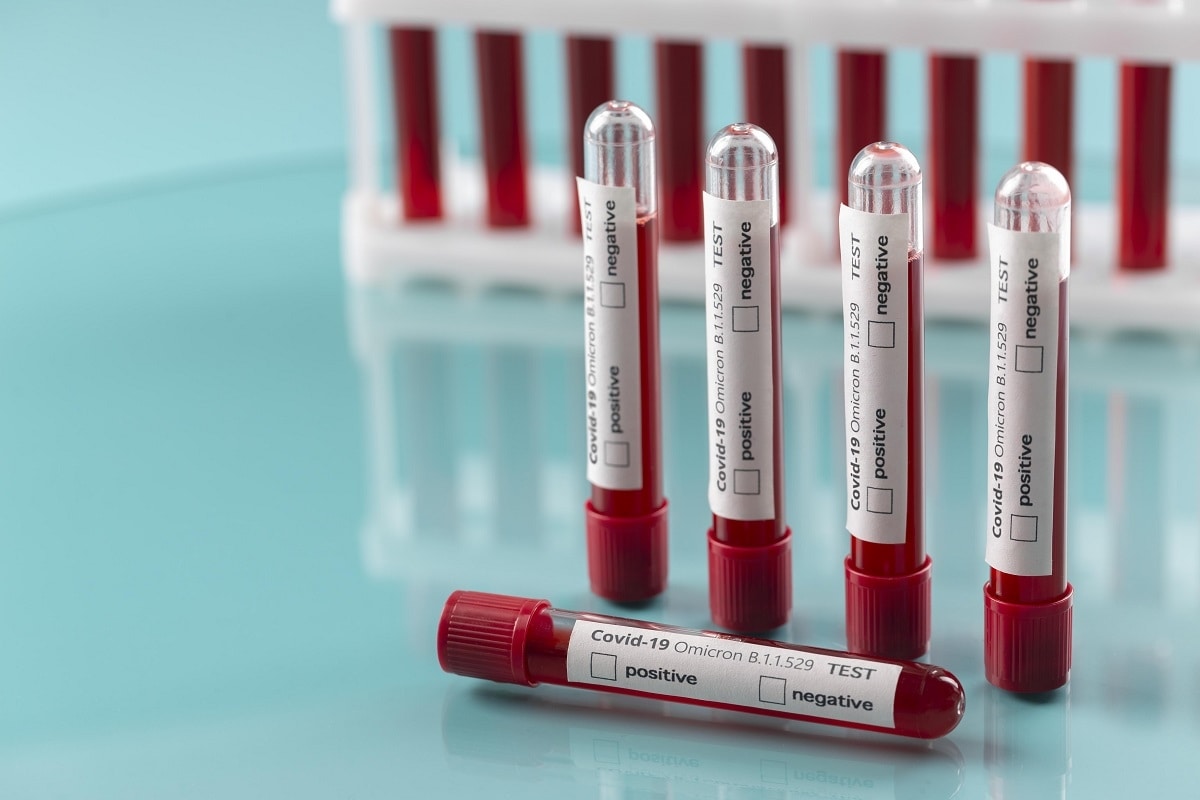 travelobiz's tweet photo. India Restarts Random Testing at Airports as Covid Cases Surge Worldwide
#Airport #BF7 #Covid19 #India #InternationalArrivals #InternationalTravellers #RandomTesting #India
https://t.co/TySZbCRjkc https://t.co/Sev39p844w