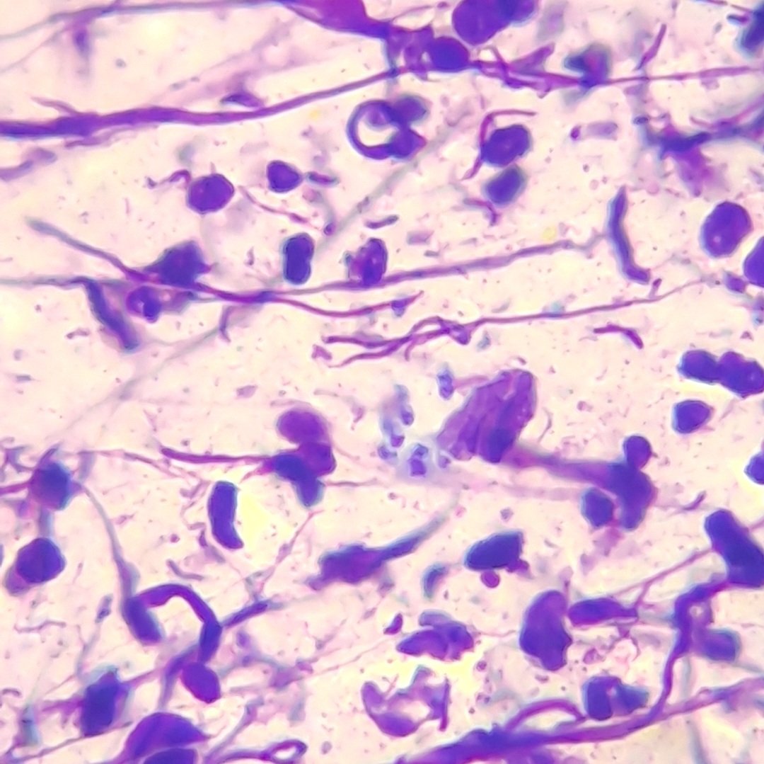 Hiwot__Mehari's tweet photo. For everyone who hasn't seen kinetoplast of a Leishmania.... There you go! #pathtwitter #pathology https://t.co/RccWnkrNlk