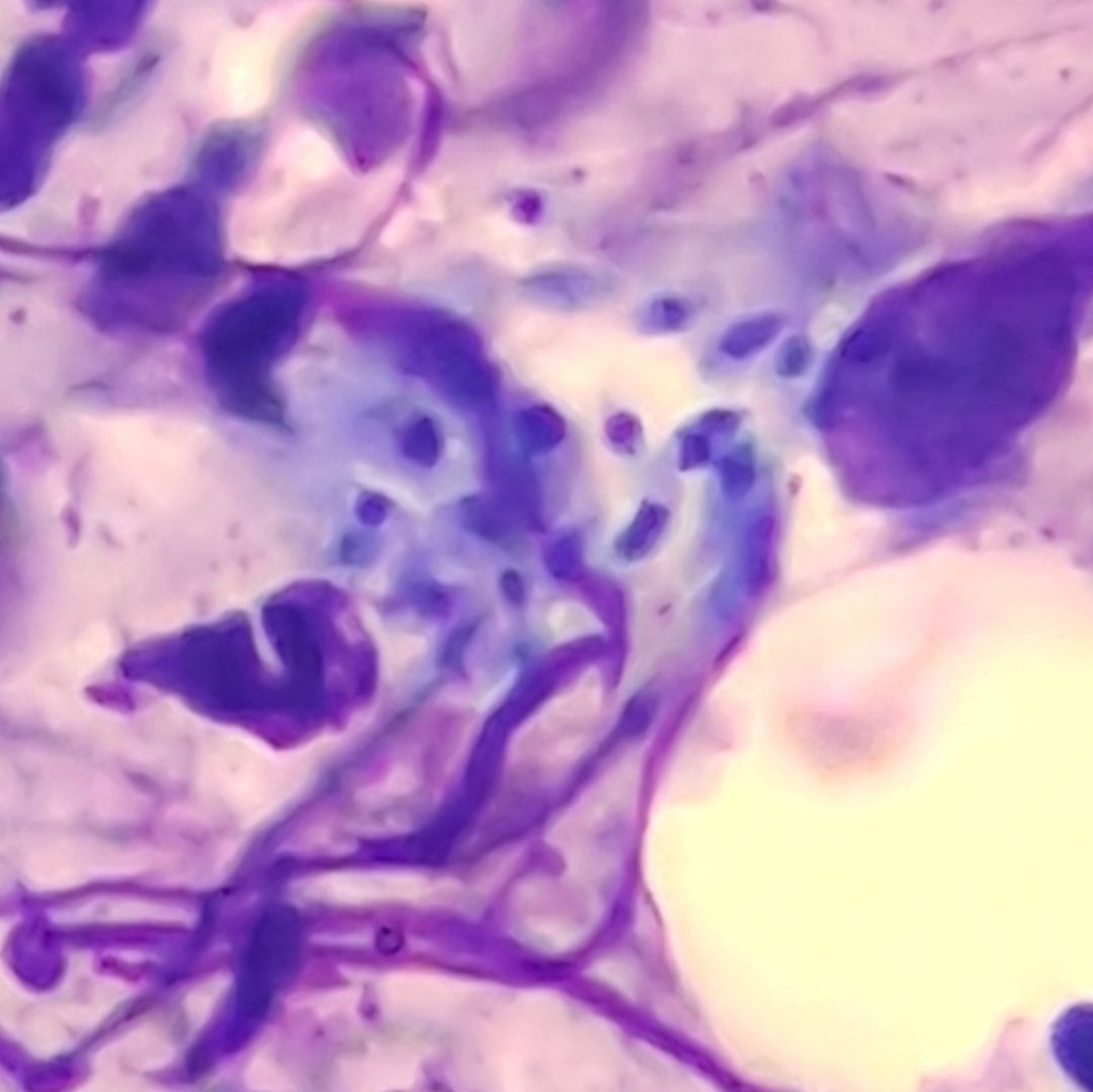 Hiwot__Mehari's tweet photo. For everyone who hasn't seen kinetoplast of a Leishmania.... There you go! #pathtwitter #pathology https://t.co/RccWnkrNlk