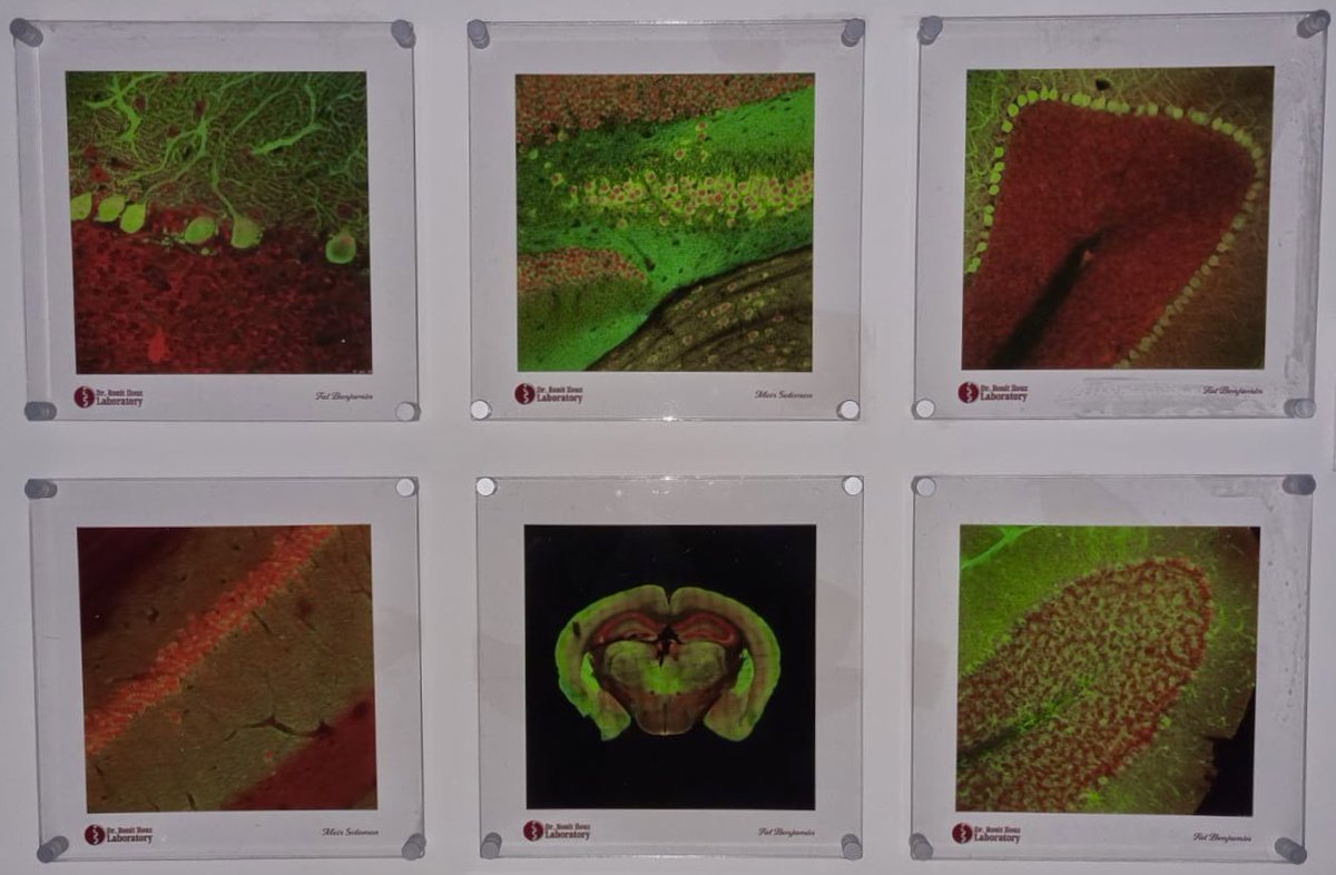 Tal Benjamin Zukerman (@talbenzuk) on Twitter photo Our new <a href="/RIlouz/">Ronit Ilouz</a> lab design.
(Including my IHC staining of PKA subunits in mouse brain) 🎓 #neuroscience #Neurology Our new <a href="/RIlouz/">Ronit Ilouz</a> lab design.
(Including my IHC staining of PKA subunits in mouse brain) 🎓 #neuroscience #Neurology