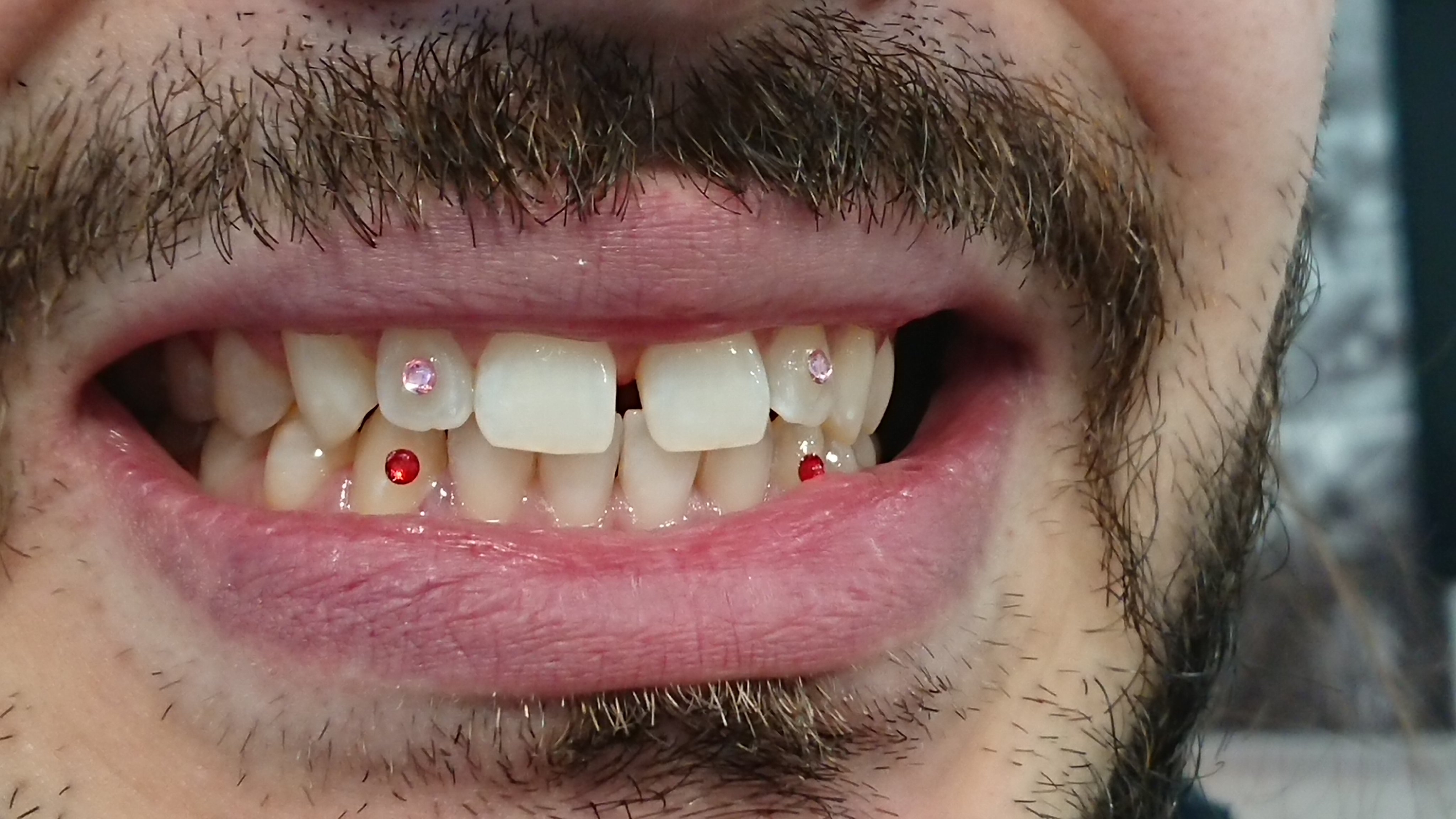 Swarovski tooth Gems