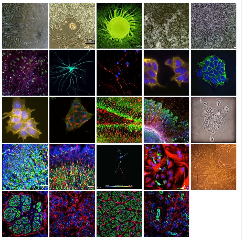 ICYMI: Grading my #stemcell &amp; regenerative #medicine predictions for 2022. A bad year for biotechs. Some cell &amp; gene therapy adverse events. Good news on some predictions tho ipscell.com/2022/12/gradin… #stemcells $ATHX $MESO $CCEL