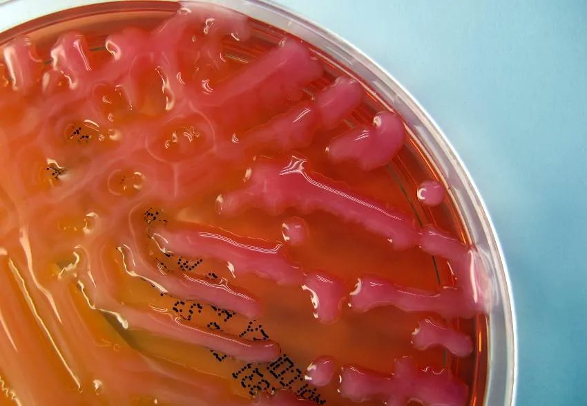 Infosalut (@infosalut) on Twitter photo #PublicaSalutib Prevalencia del operon fimbrial mrkABCD, expresión mrkA, formación de biofilm y efecto de los biocidas en la formación biofilm en aislados de Klebsiella pneumoniae productores de... buff.ly/3jjwxn0 <a href="/microHUSE/">Microbiología Clínica HUSE</a> <a href="/aoliverp73/">Antonio Oliver</a> <a href="/erojomol/">Estrella RM</a> buff.ly/3hKWH1F #PublicaSalutib Prevalencia del operon fimbrial mrkABCD, expresión mrkA, formación de biofilm y efecto de los biocidas en la formación biofilm en aislados de Klebsiella pneumoniae productores de... buff.ly/3jjwxn0 <a href="/microHUSE/">Microbiología Clínica HUSE</a> <a href="/aoliverp73/">Antonio Oliver</a> <a href="/erojomol/">Estrella RM</a> buff.ly/3hKWH1F