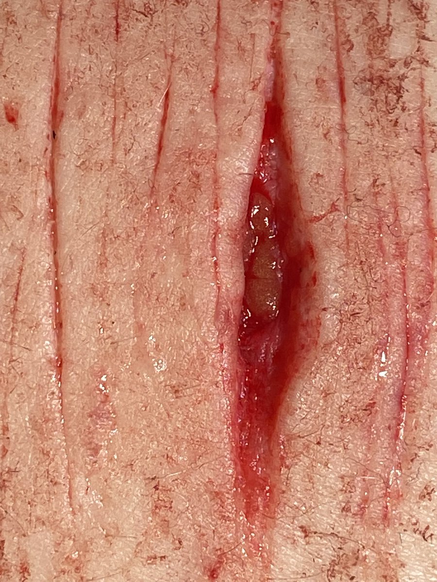 bensbladez's tweet photo. They’re so fun to play with

SFX MAKEUP

tw very good sh sfx makeup #beans #beanstwt #shtwt #5htwt #cuttwt https://t.co/786BpVeNId
