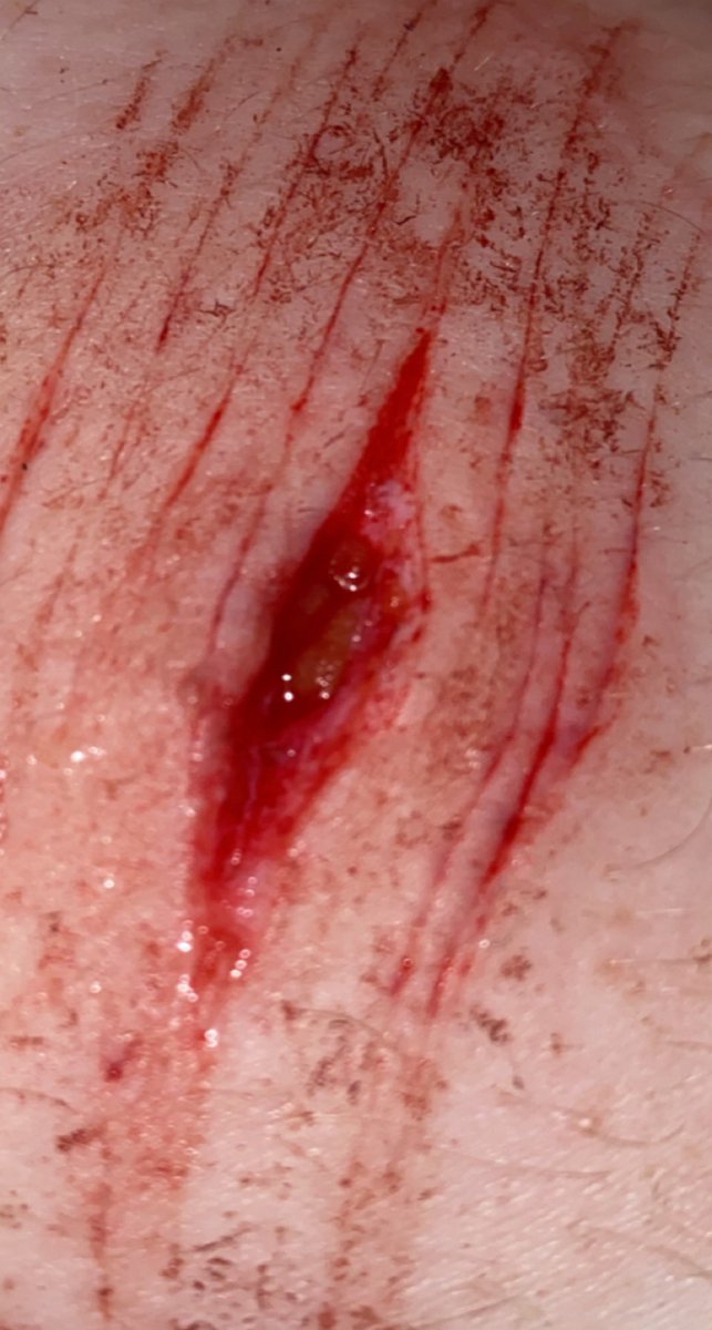 bensbladez's tweet photo. They’re so fun to play with

SFX MAKEUP

tw very good sh sfx makeup #beans #beanstwt #shtwt #5htwt #cuttwt https://t.co/786BpVeNId