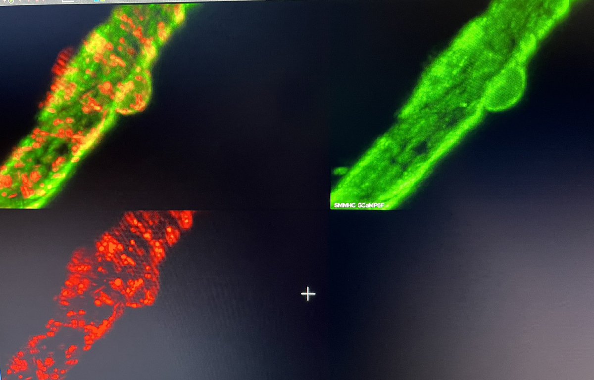 Pericytes are so pretty 🤩 #neuropharm #exvivo