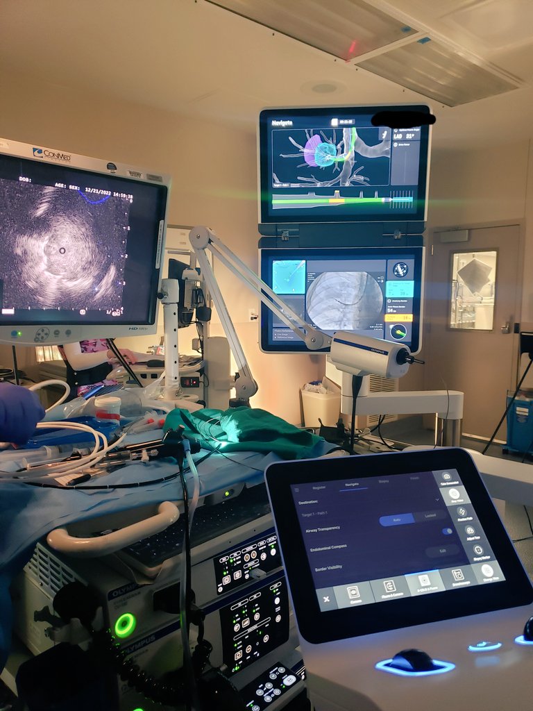 Robotic bronchs are cool