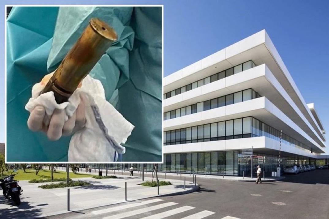 A man with a WWI explosive lodged in his rectum evacuates a hospital‼️😳