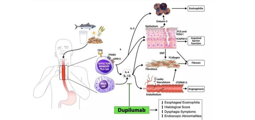 Congrats to <a href="/RothenbergLab/">Rothenberg CURED Research Lab</a> and colleagues. These findings <a href="/NEJM/">NEJM</a> are great news for people with #EoE !
#foodallergy #dupilumab 
Study: nejm.org/doi/full/10.10… Blog: scienceblog.cincinnatichildrens.org/biological-age…