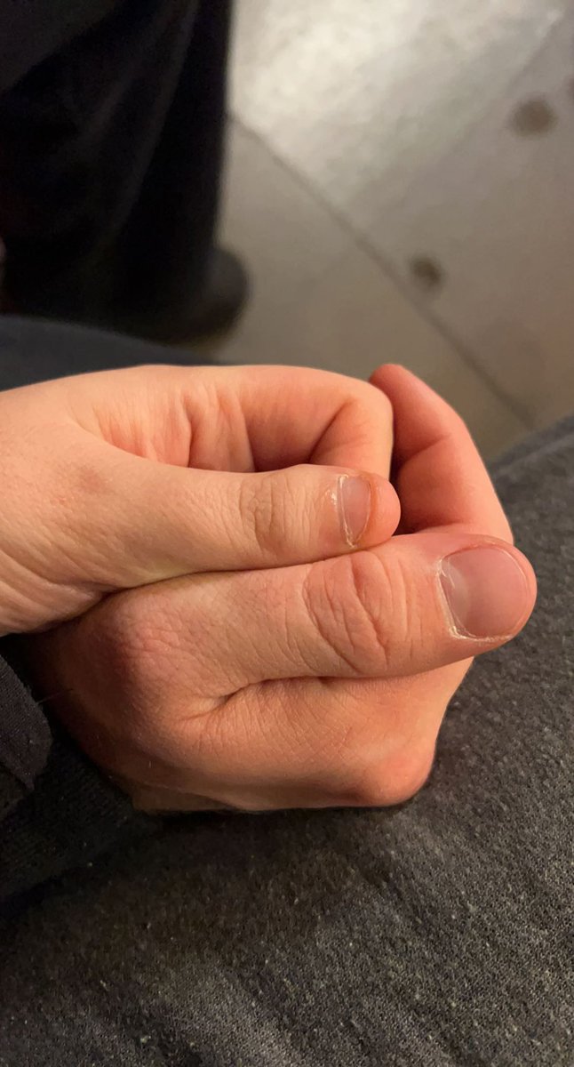 campbellsoupps's tweet photo. This feels nsfw. #meganfoxthumbs https://t.co/Rgsamg74D8