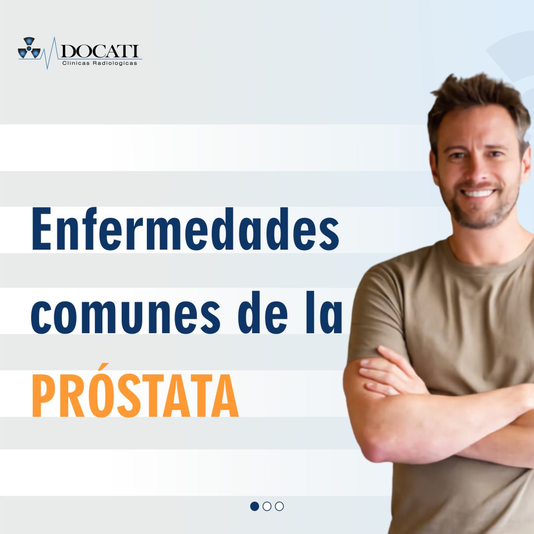 ➖ Necesidad de orinar mucho
➖ Filtración o goteo de orina
➖ No poder orinar
➖ Fiebre
➖ Escalofríos
➖ Dolor al orinar. 

Realizamos Ultrasonido Testicular (escrotal)

#InfoDocati #Prostata #UltrasonidoTesticular