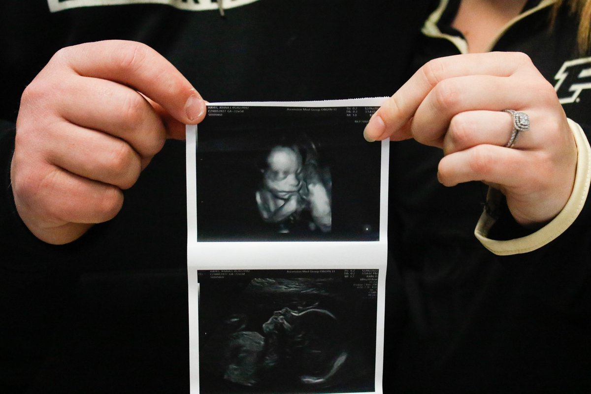 JWitter32's tweet photo. Introducing our newest addition to the Hayes lineup...Stetson Porter Hayes💙
Due April 2023🏀 https://t.co/miAQfYPQNX