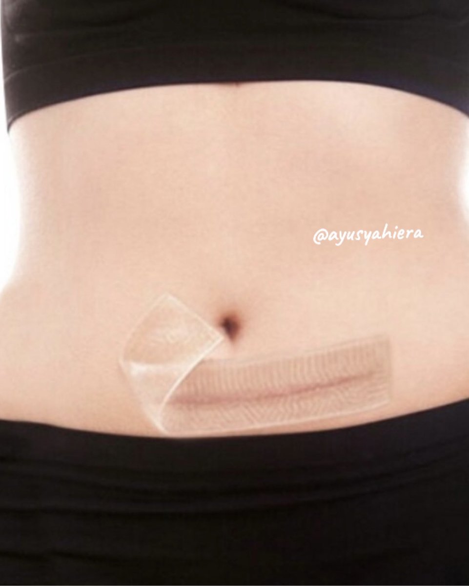 Yang bersalin czer wajib cuba silicone scar sheet ni😄 Reccomended! Yang bestnya dia boleh hilangkan parut Czer🥹 Pelekat ni boleh dibasuh &amp; diguna balik sampai 2weeks. Yang penting x mahal. Selamat untuk ibu mengandung dan menyusu.
.
Beli kat sini je👉🏻 shope.ee/5KcqZnfyi1