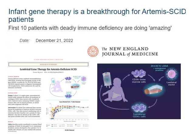 Encouraging news for the 1st Artemis "Bubble-Babies" to undergo new gene🧬therapy
_News: sciencedaily.com/releases/2022/… #bioinformatics #openscience #snrtg #iot
_Journal: nejm.org/doi/10.1056/NE… #raredisease #immunology #genomics