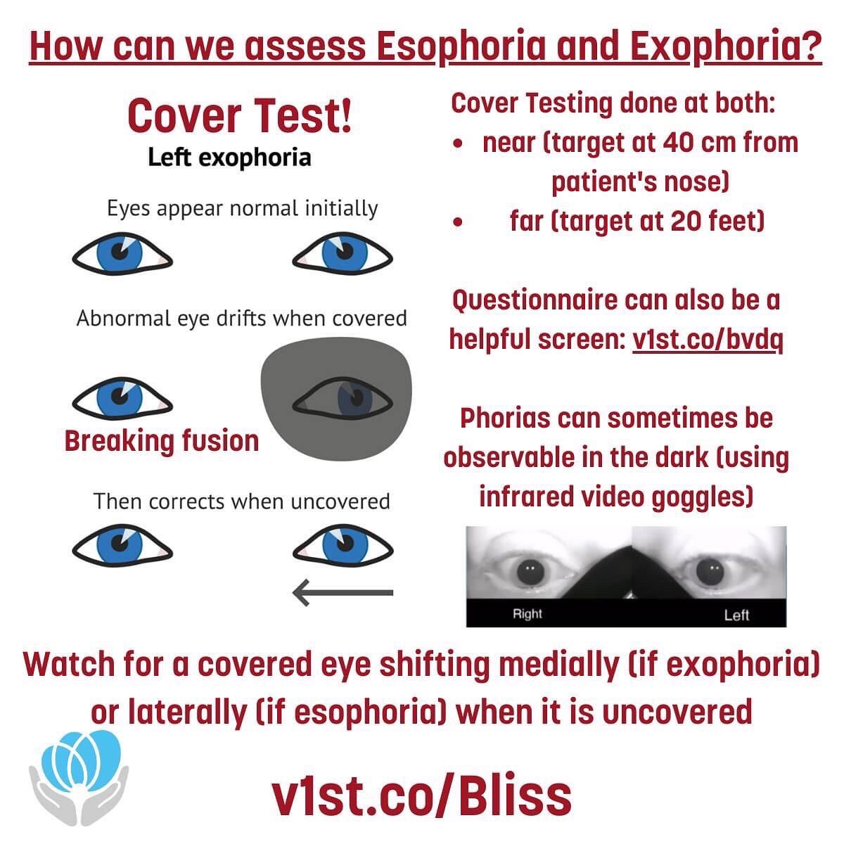 VestibularFirst's tweet image. Eye misalignment after concussion - is it contributing to your patient's headaches, difficulty reading, or fatigue? Learn more at our Jan 10th Journal Club or watch on-demand afterwards. Register v1st.co/Bliss #concussion #neurology #migraine #optometry #ophthalmology